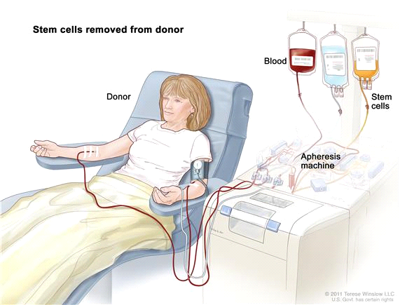Stem Cell Transplant